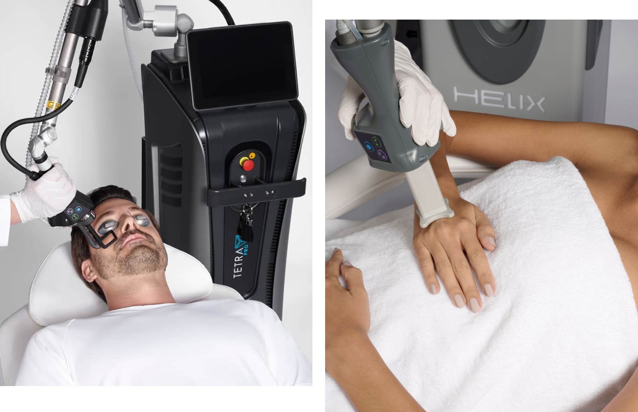 Official CoolPeel treatment photography showing facial and hand resurfacing